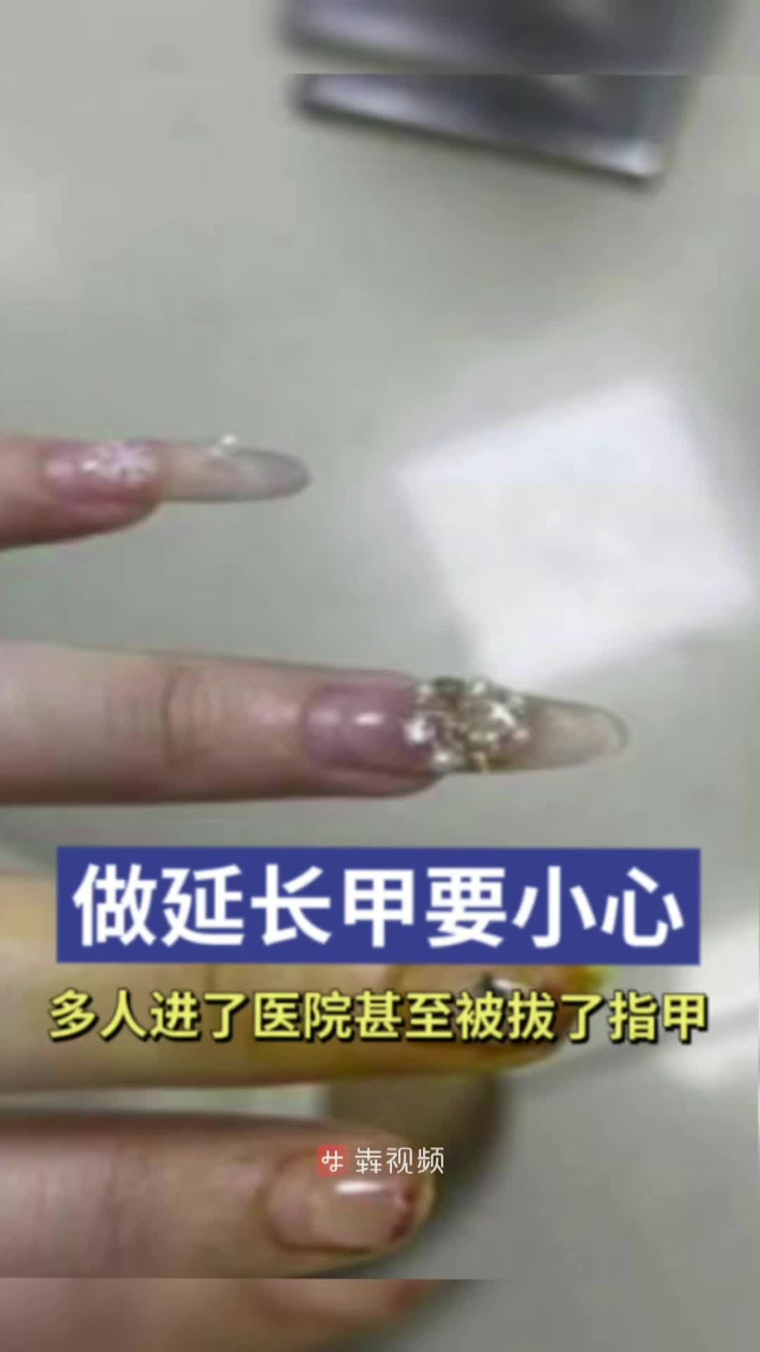 爱做延长甲的女孩注意咯，有人因此被拔了指甲