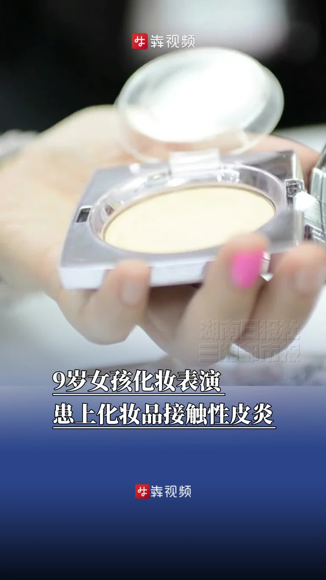 警惕！9岁女孩化妆表演，患上化妆品接触性皮炎
