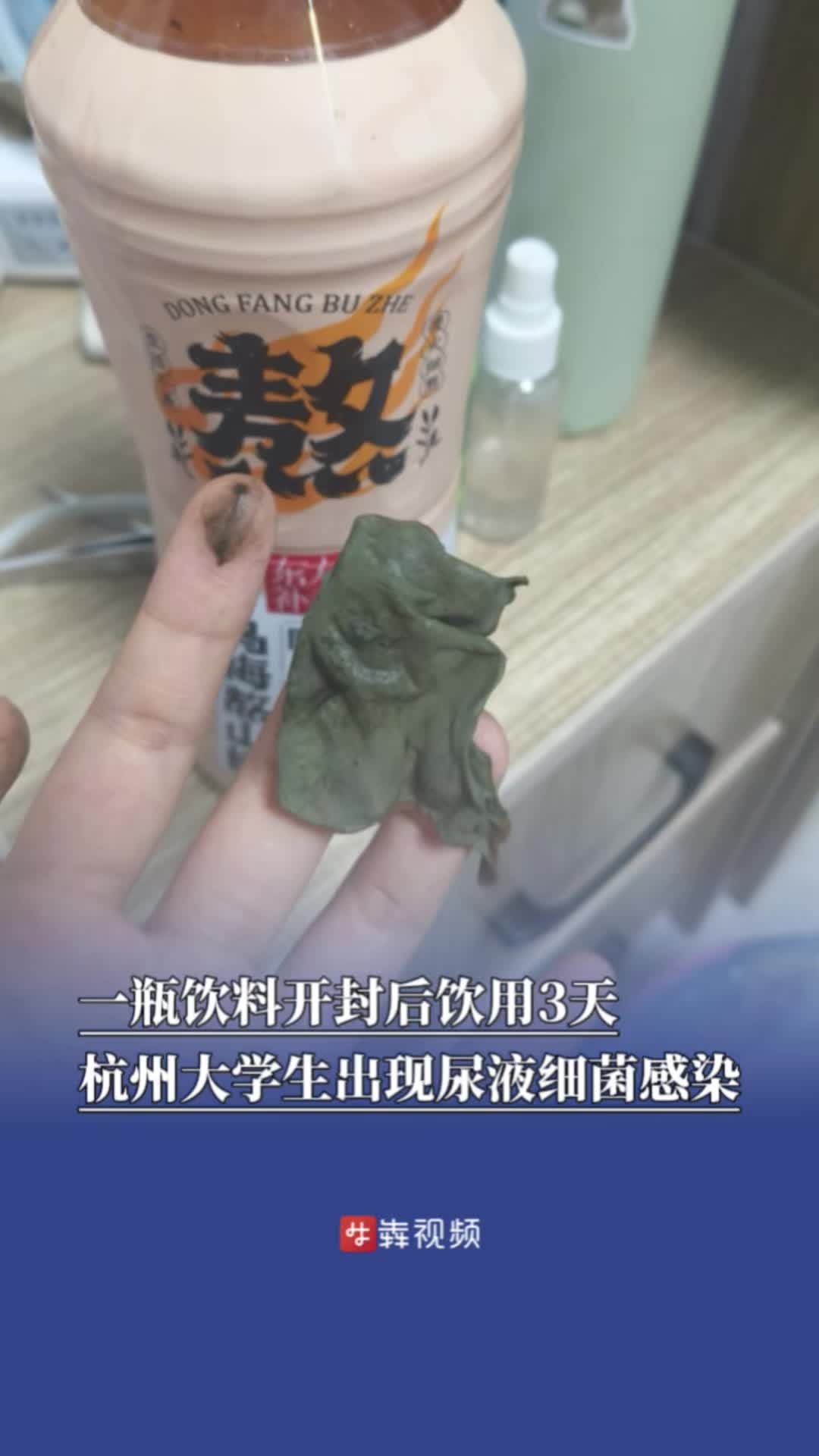 一瓶飲料開封后飲用3天，杭州大學(xué)生出現(xiàn)尿液細(xì)菌感染