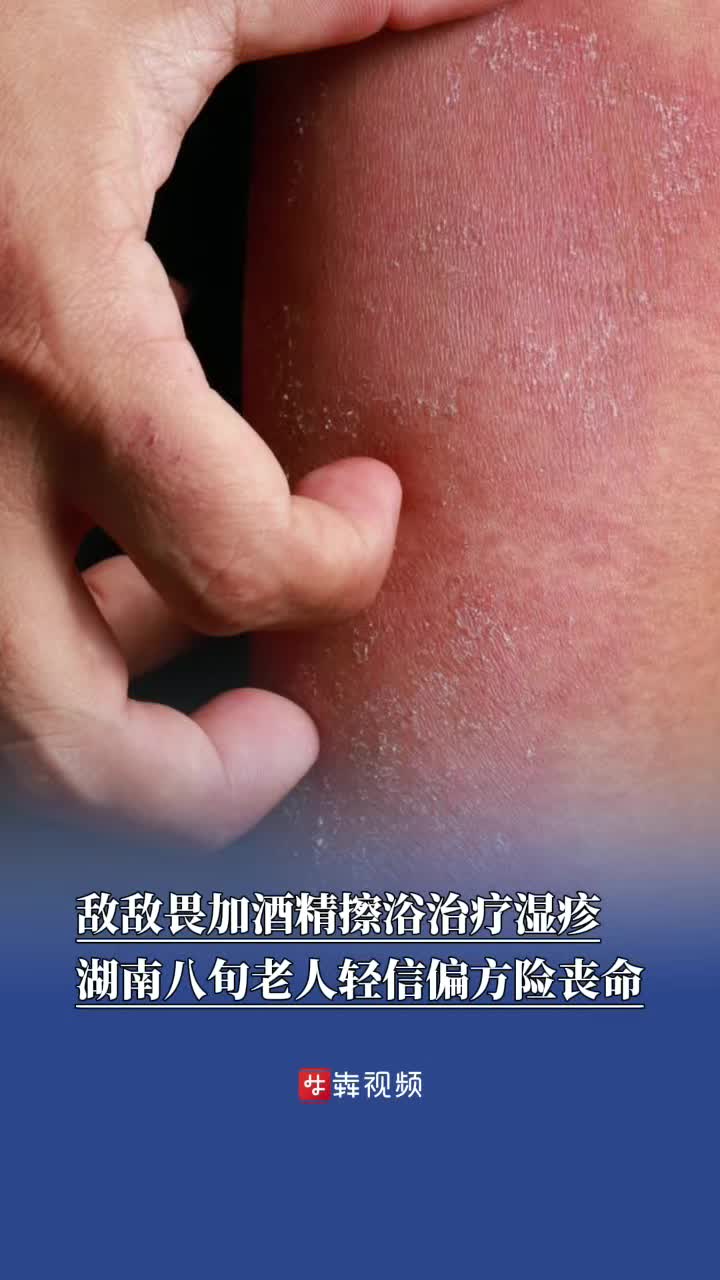 敵敵畏加酒精擦浴治濕疹，老人輕信偏方險喪命