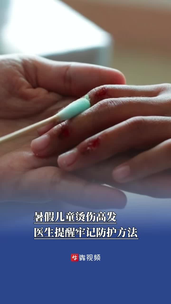 兒童燙傷高發(fā)，醫(yī)生提醒這些防護(hù)要牢記