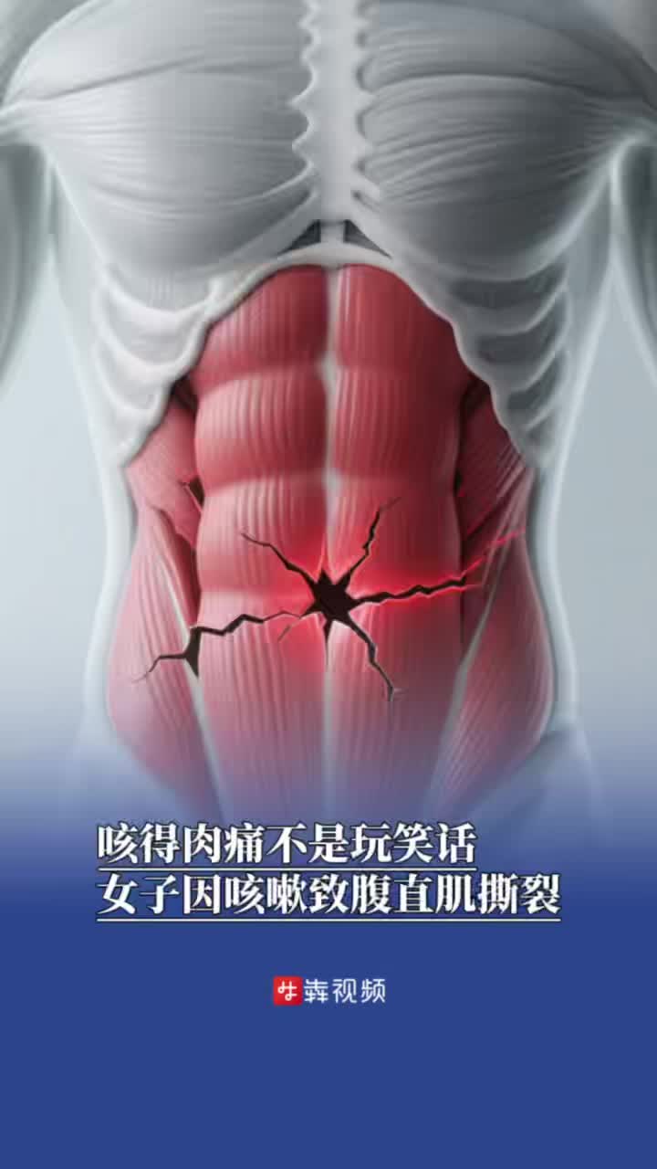 咳得肉痛不是開玩笑，女子因咳嗽致腹直肌撕裂