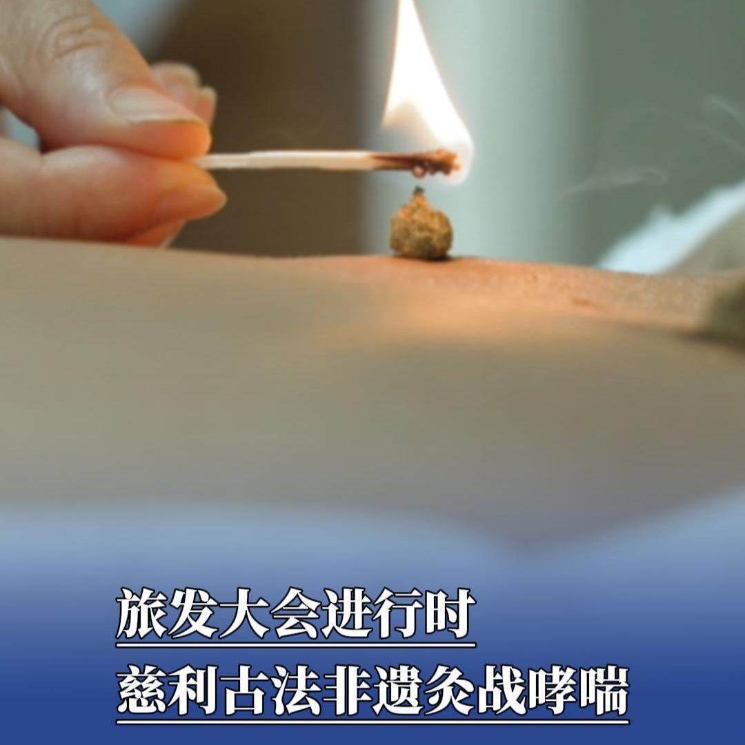 旅發(fā)大會進(jìn)行時，慈利古法非遺灸戰(zhàn)哮喘