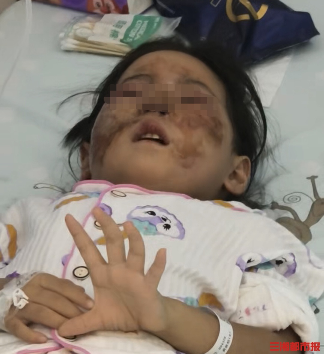 坐副駕不系安全帶，5歲女童車禍中受傷